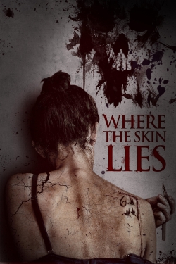 Watch Where the Skin Lies movies free hd online